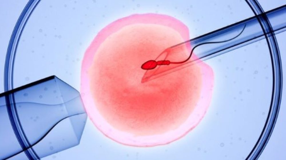 PRAKSE IZKLJUČEVANJA ŽENSK PRI PRAVICI DO OPLODITVE Z BIOMEDICINSKO POMOČJO